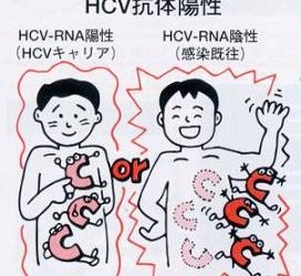 hcv-oriente.jpg