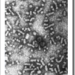 virus hepatitis b hbv vhb