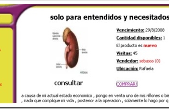 venta-de-organos