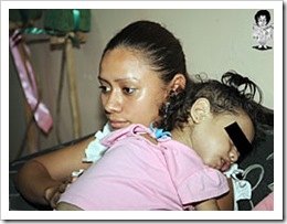 honduras-higado-hepatitis-trasplante