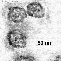 La imagen microscópica de la hepatitis C. Foto: Wikipedia.