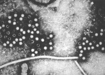 Hepatitis_E_virus.jpg