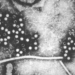 Hepatitis_E_virus.jpg