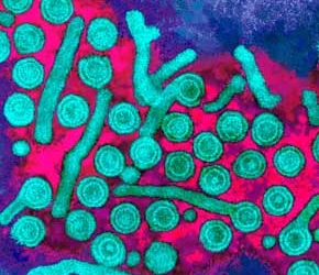 hepatitisb1.jpg