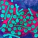 hepatitisb1.jpg
