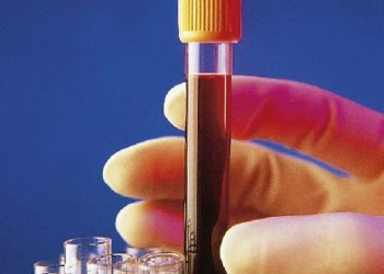 hepatitis-c-chile.jpg