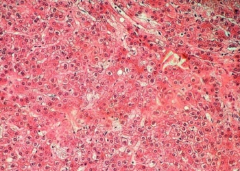 hepatocitos-celulas-hepaticas.jpg