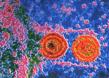 herpes-genital.jpg