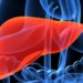 encefalopatia-hepatica-cirrosis.jpg