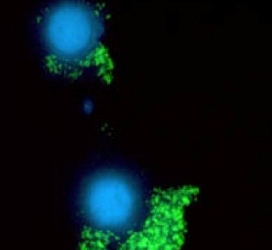 celulas-infectadas-por-hepatitis-bc.jpg
