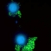 celulas-infectadas-por-hepatitis-bc.jpg