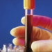 hepatitis-c-sangre.jpg
