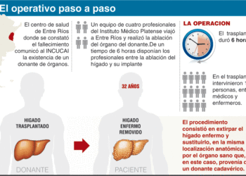 trasplante-de-higado-en-la-plata-hepatico.gif