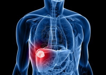 forma-de-cuerpo-humano-con-cancer-de-higado.jpg