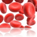 anemia