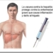 hepatitis-b