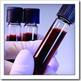 sangre hepatitis