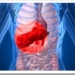 hepatitis-c-higado