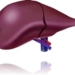 hepatitis-liver