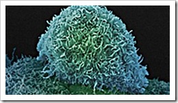 cancer_células_linfocitos_NK