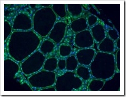 LKB1-Proteina.tumor-higado