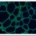 LKB1-Proteina.tumor-higado