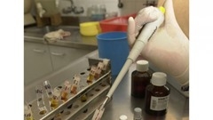 analisis-hepatitis