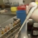 analisis-hepatitis