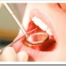 odontologos-esterilizacion-contagio