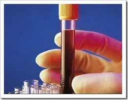 Analisis-de-sangre