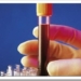 Analisis-de-sangre