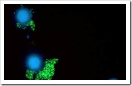 vhc-virus-hepatitis-c