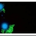 vhc-virus-hepatitis-c