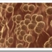 vhc-hcv