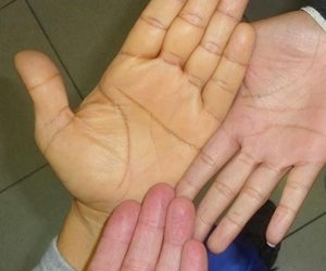 Saludhepatitis02-File03