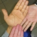 Saludhepatitis02-File03