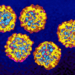 heptatsis