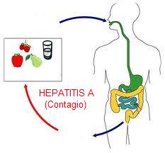 hepatitis-A