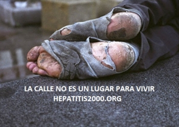 sin-hogar-hepatitis2000-situacion-de-calle