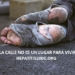 sin-hogar-hepatitis2000-situacion-de-calle