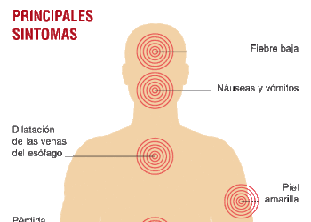 hepatitis-en argentina