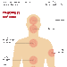 hepatitis-en argentina