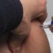vacuana-hepatitis-b