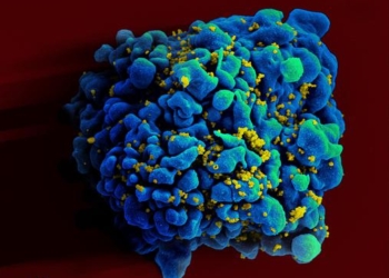 HIV-infected H9 T-cell