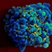 HIV-infected H9 T-cell