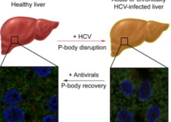 hepatitis-celulas