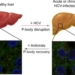 hepatitis-celulas