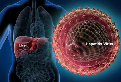 webmd_rf_photo_of_liver_and_hepatitis_virus