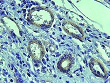  Vasos patológicos (círculos blancos), con abundante expresión de la proteína CPEB4, en tejido cirrótico. / IRB BARCELONA/IDIBAPS
