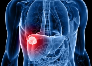 Signos-silenciosos-del-Cáncer-de-hígado.jpg